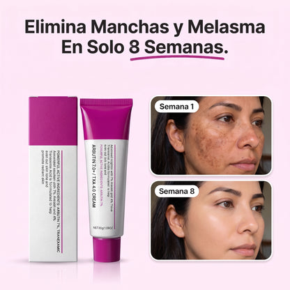 CREMA ARBUTINA