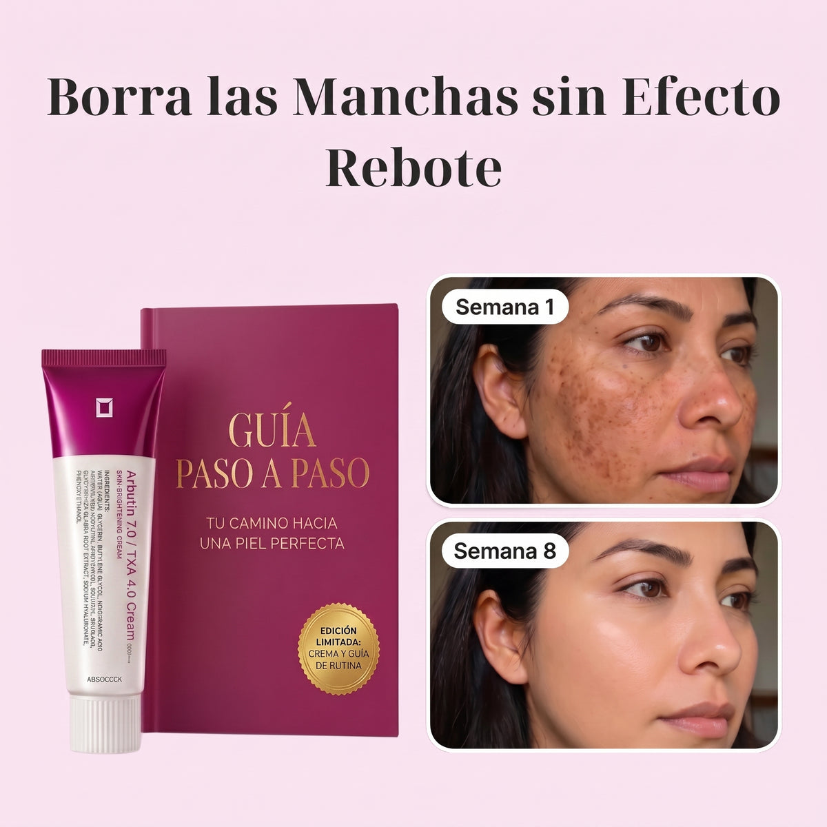 CREMA DESPIGMENTANTE DE MANCHAS - EVOLEX
