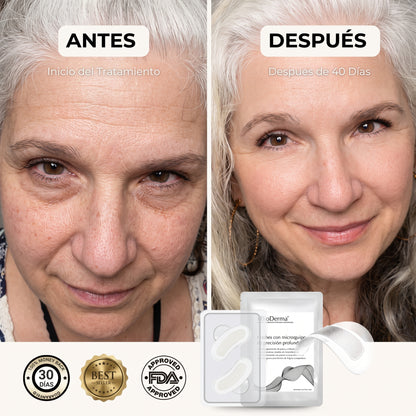 Parches Hidratantes Antiojeras 10 Pares - Evolex
